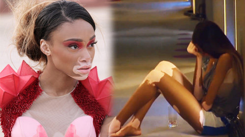 《全美超模大赛 第21季》13集预告:白癜风女模惹怒众人被孤立_综艺